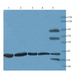 Western blot analysis of rat kidney (lane 1), rat large intestines (lane 2), mouse spleen (lane 3), rat ovary (lane 4); Hela cells (lane 5) using CD105 antibody (3 ug/ml)