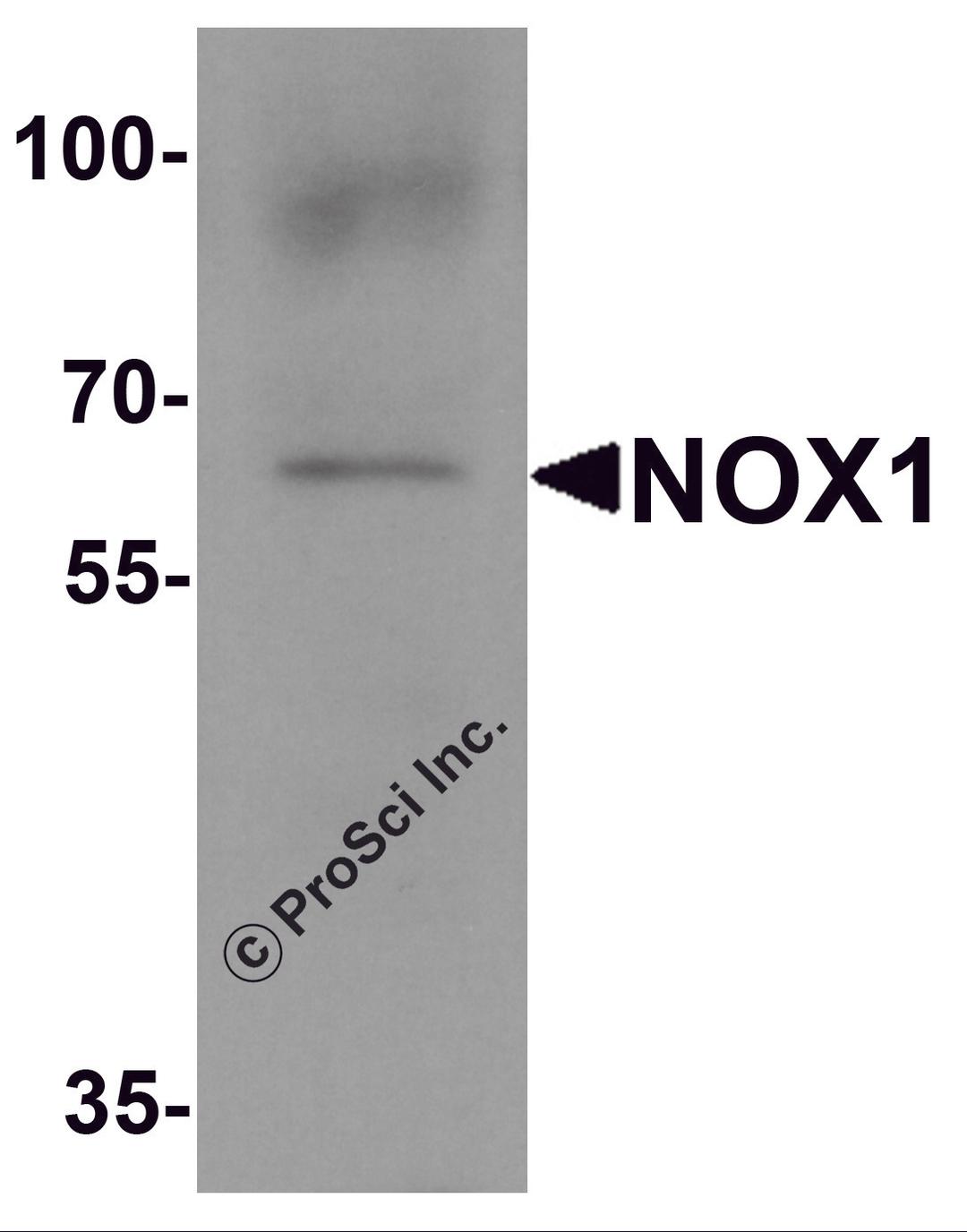 Western blot analysis of NOX1 in 293 cell lysate with NOX1 antibody at 1 μg/ml.