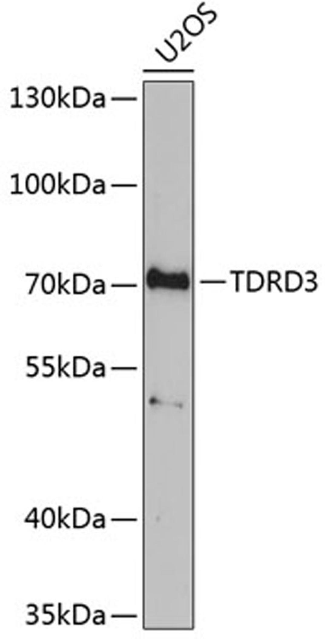 Western blot - TDRD3 antibody (A6000)