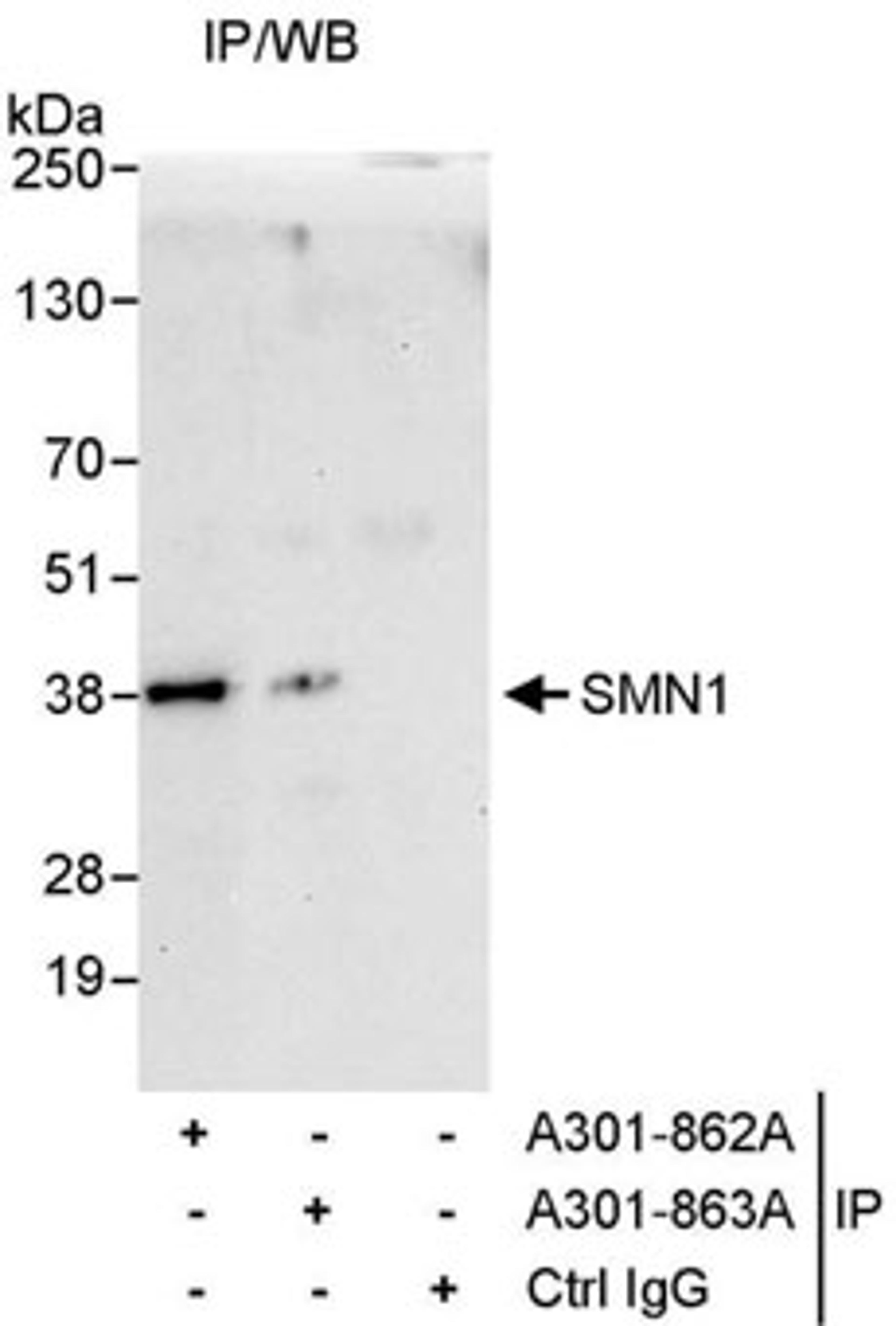 Detection of human SMN1 by western blot of immunoprecipitates.