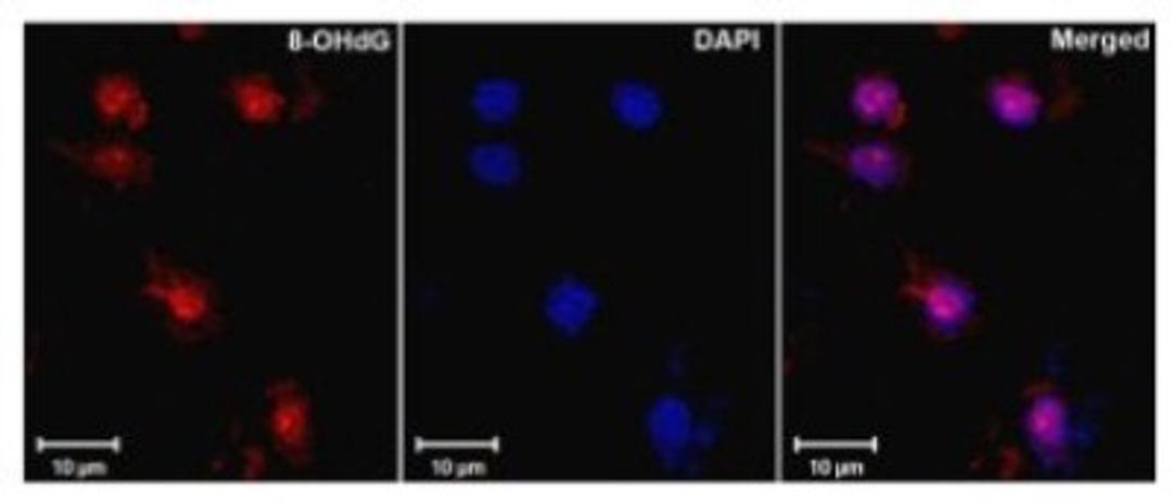 Immunohistochemistry: DNA/RNA Damage Antibody (15A3) [NB110-96878] - Used against oxidized 8-OH-dG in ischemic rat brain tissue. Left to right: 8-OH-dG, DAPI, merged. Courtesy of Dr. Yang, University of New Mexico, USA.