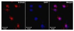 Immunohistochemistry: DNA/RNA Damage Antibody (15A3) [NB110-96878] - Used against oxidized 8-OH-dG in ischemic rat brain tissue. Left to right: 8-OH-dG, DAPI, merged. Courtesy of Dr. Yang, University of New Mexico, USA.