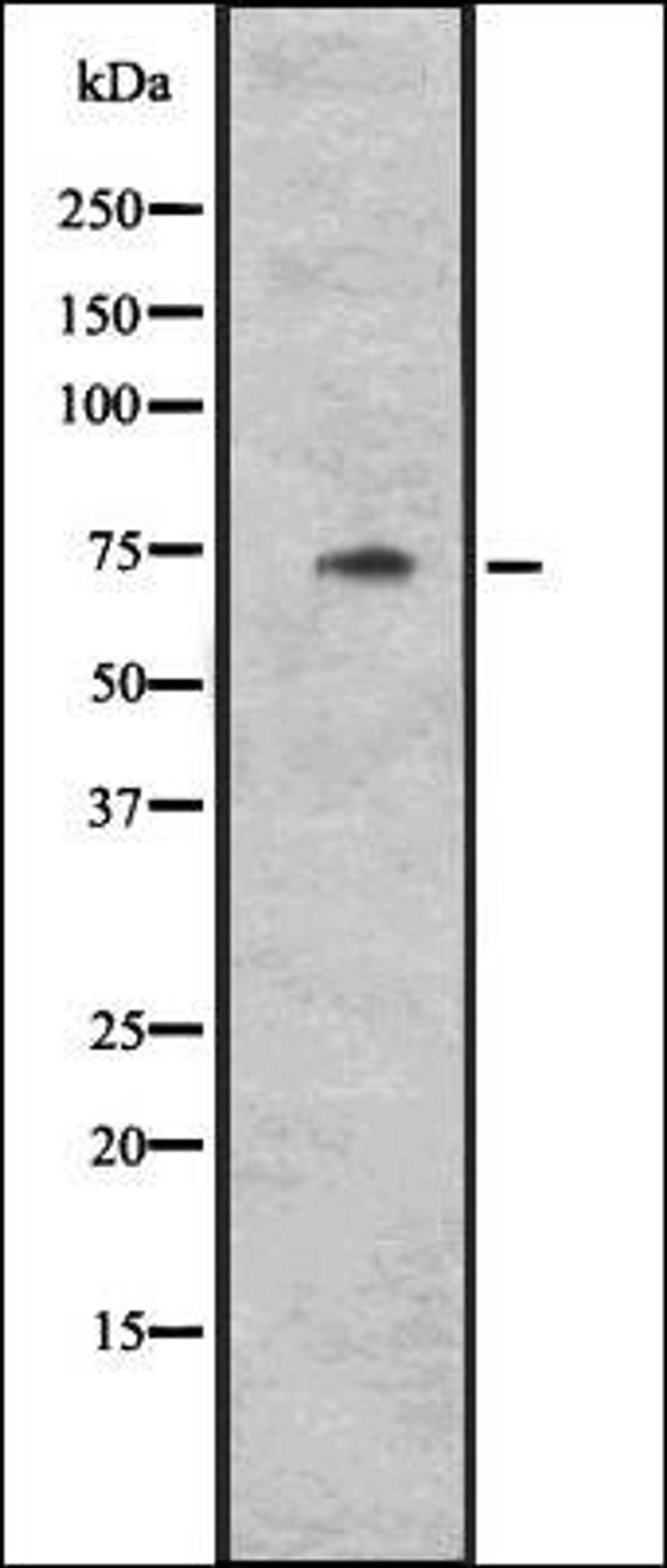 Western blot analysis of Hela cell lysate using CYLC1 antibody