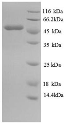(Tris-Glycine gel) Discontinuous SDS-PAGE (reduced) with 5% enrichment gel and 15% separation gel.