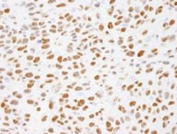 Detection of mouse Phospho XRCC1 (S485/T488) by immunohistochemistry.