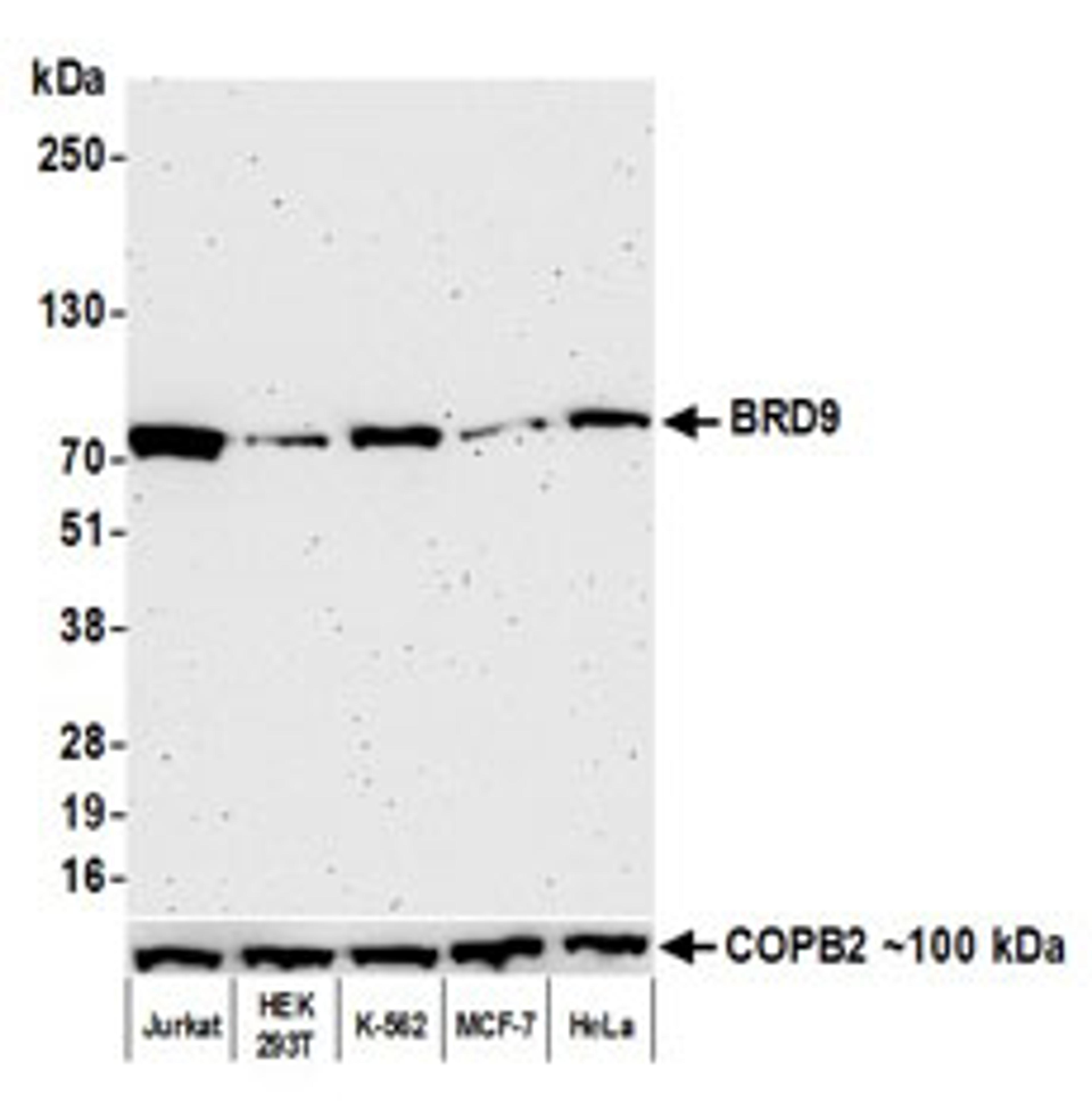 Detection of human BRD9 by western blot.