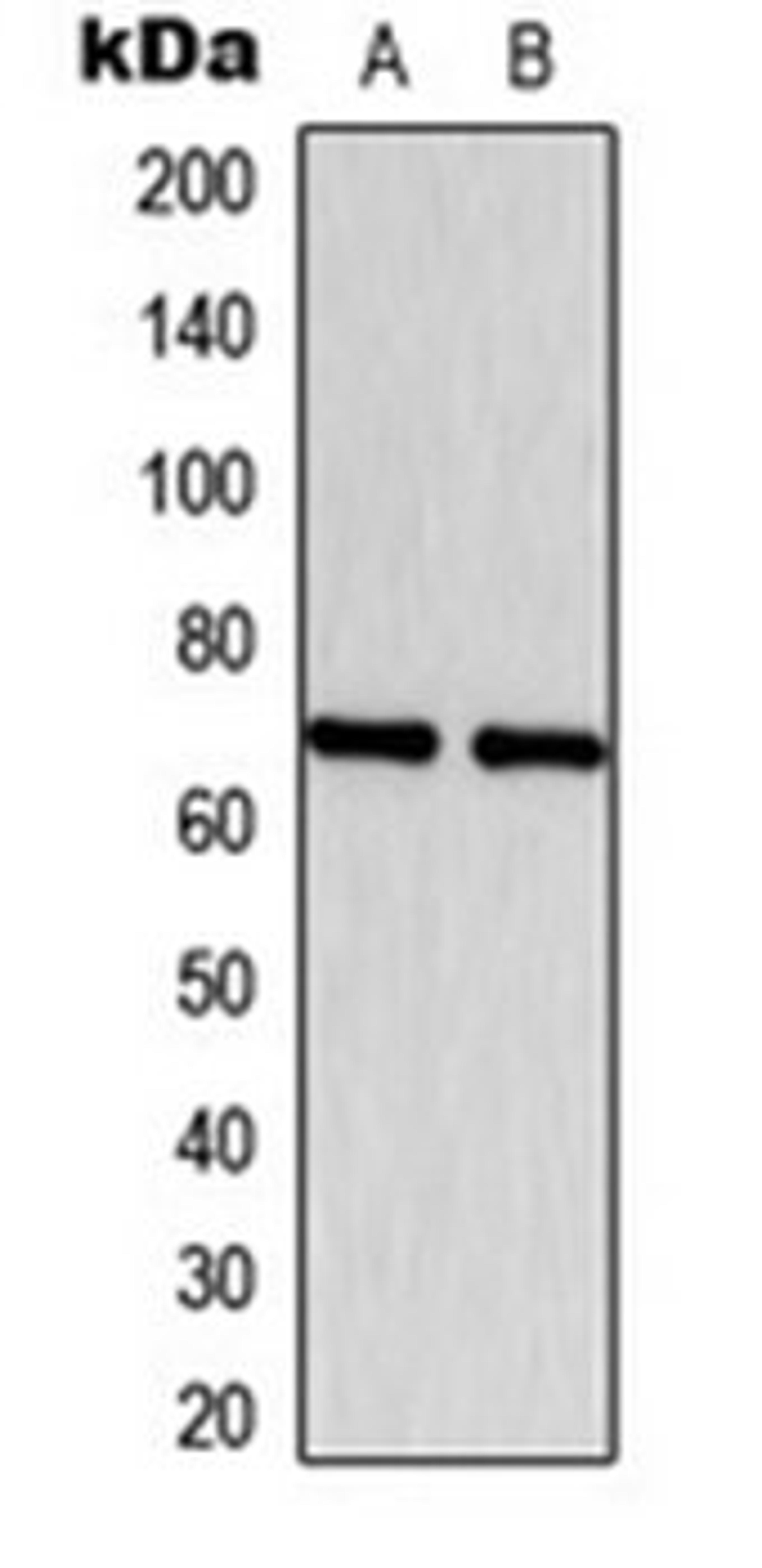 Western blot analysis of MCF7 (Lane 1), NIH3T3 (Lane 2) whole cell lysates using ESR1 antibody