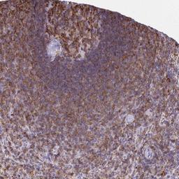 Immunohistochemistry-Paraffin: MUDENG Antibody [NBP2-33765] - Immunohistochemical staining of human spleen shows strong cytoplasmic positivity in cells in white pulp.