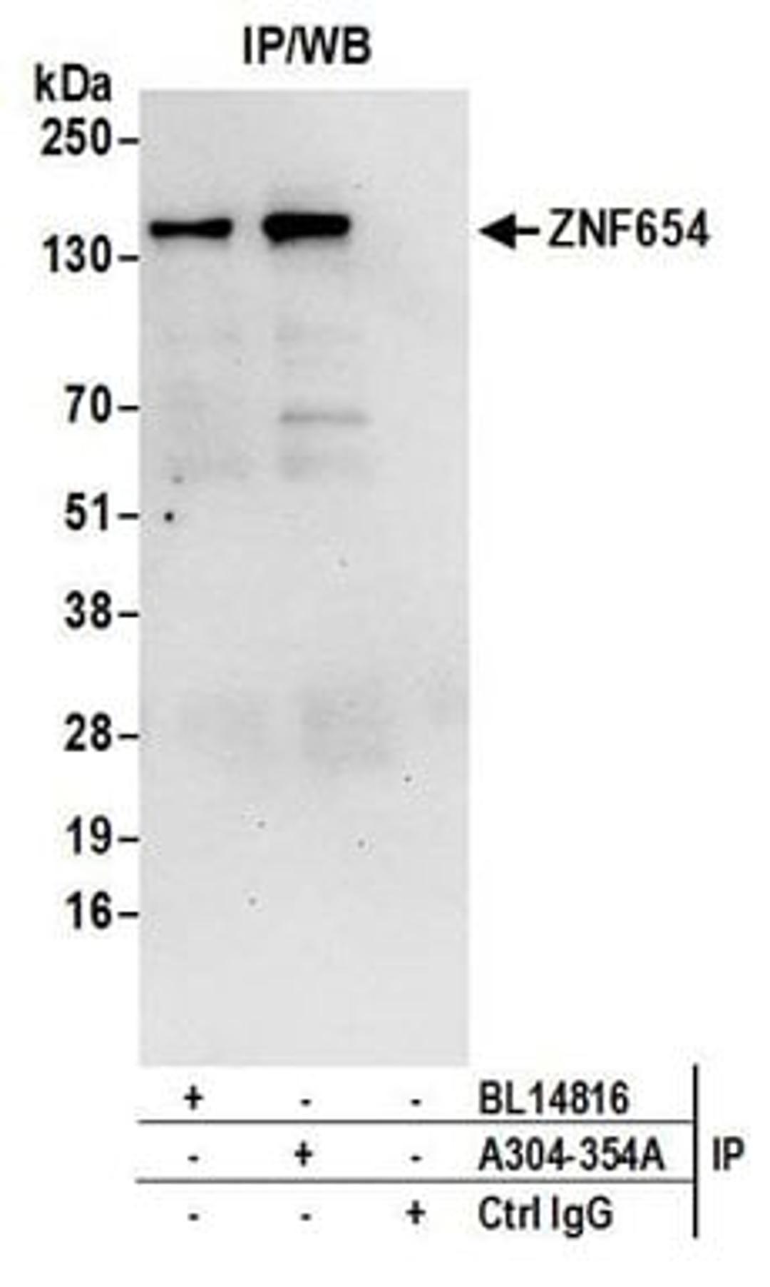 Detection of human ZNF654 by western blot of immunoprecipitates.