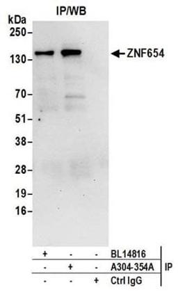 Detection of human ZNF654 by western blot of immunoprecipitates.