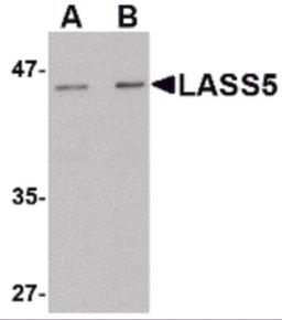 Western blot analysis of LASS5 in rat brain tissue lysate with LASS5 antibody at (A) 1 and (B) 2 &#956;g/mL.