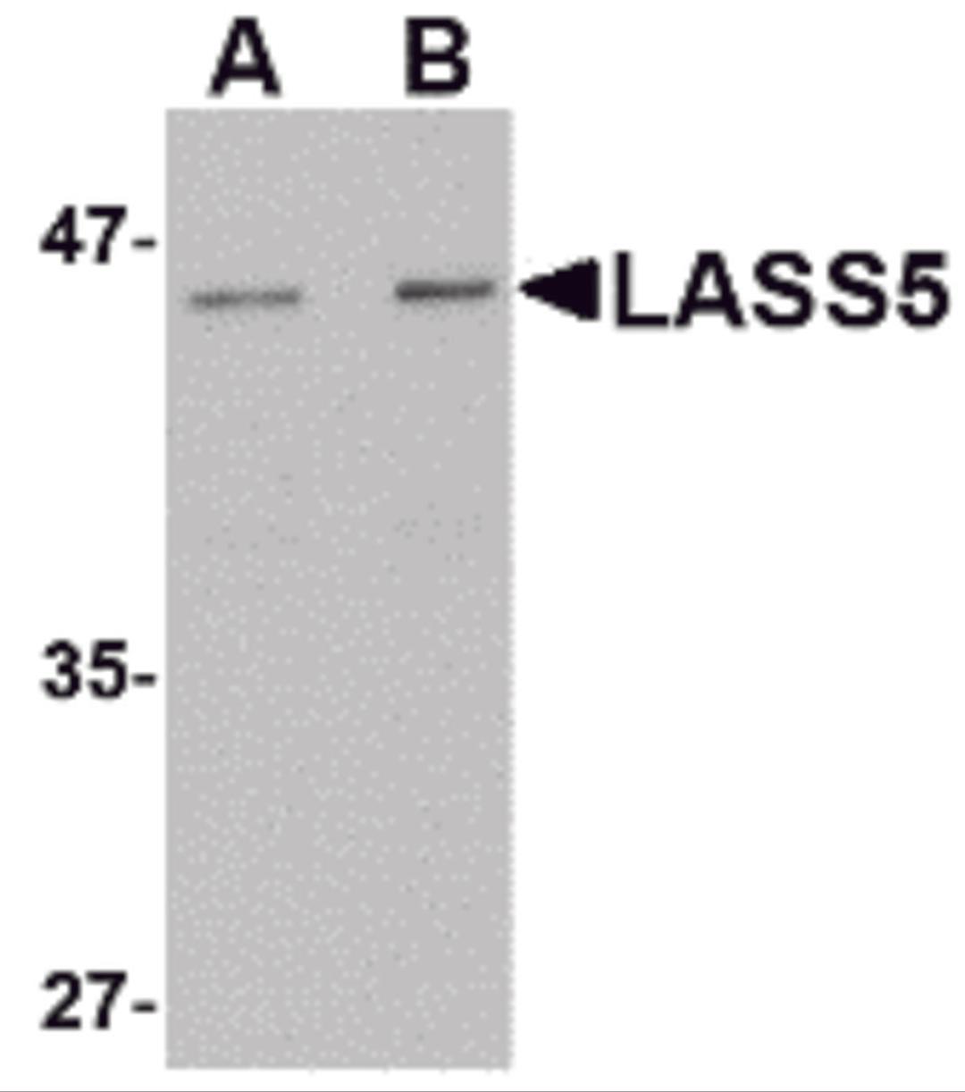 Western blot analysis of LASS5 in rat brain tissue lysate with LASS5 antibody at (A) 1 and (B) 2 μg/mL.