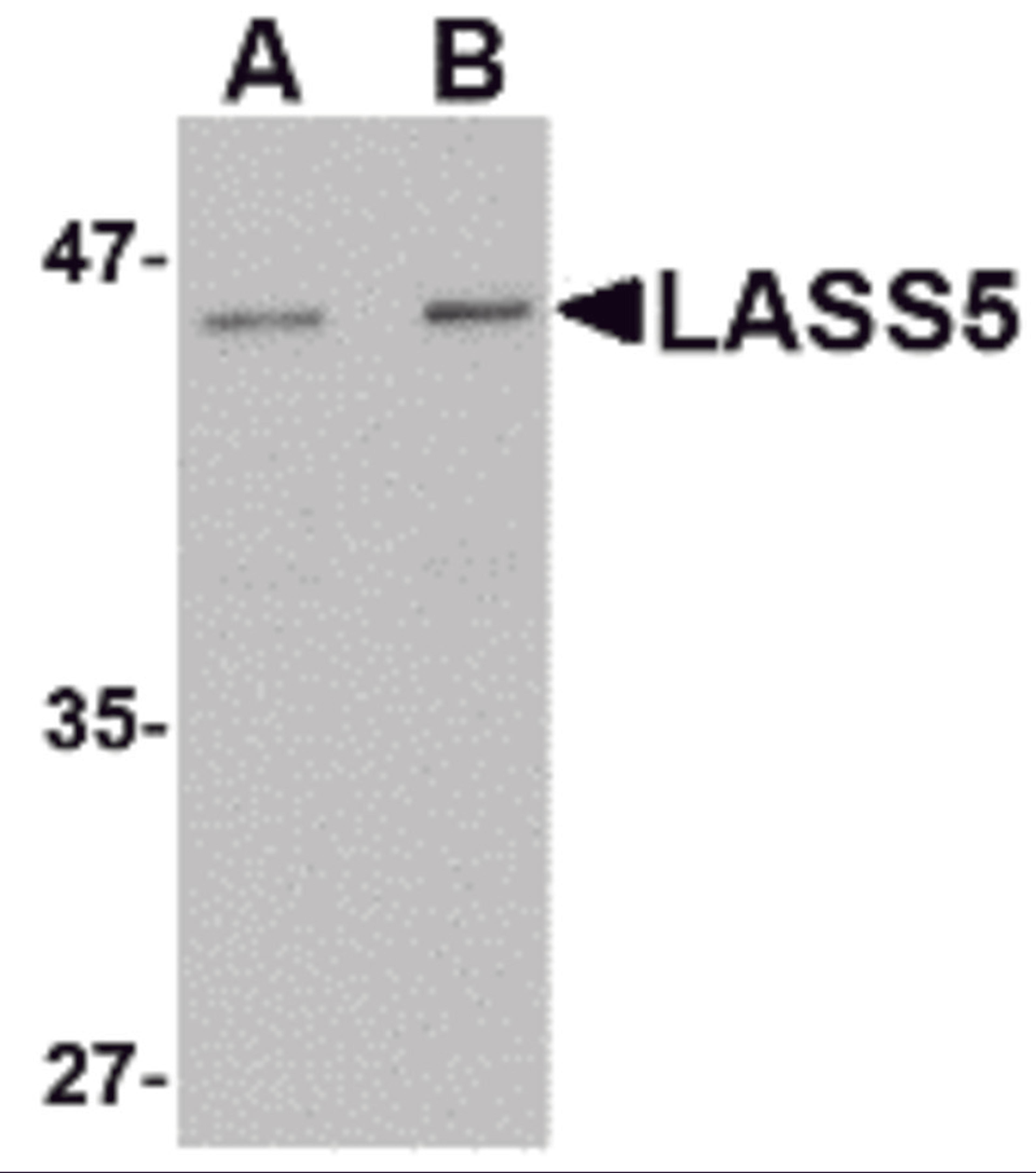 Western blot analysis of LASS5 in rat brain tissue lysate with LASS5 antibody at (A) 1 and (B) 2 μg/mL.