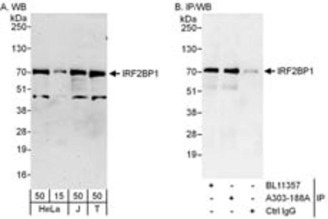 Detection of human IRF2BP1 by western blot and immunoprecipitation.