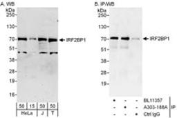 Detection of human IRF2BP1 by western blot and immunoprecipitation.