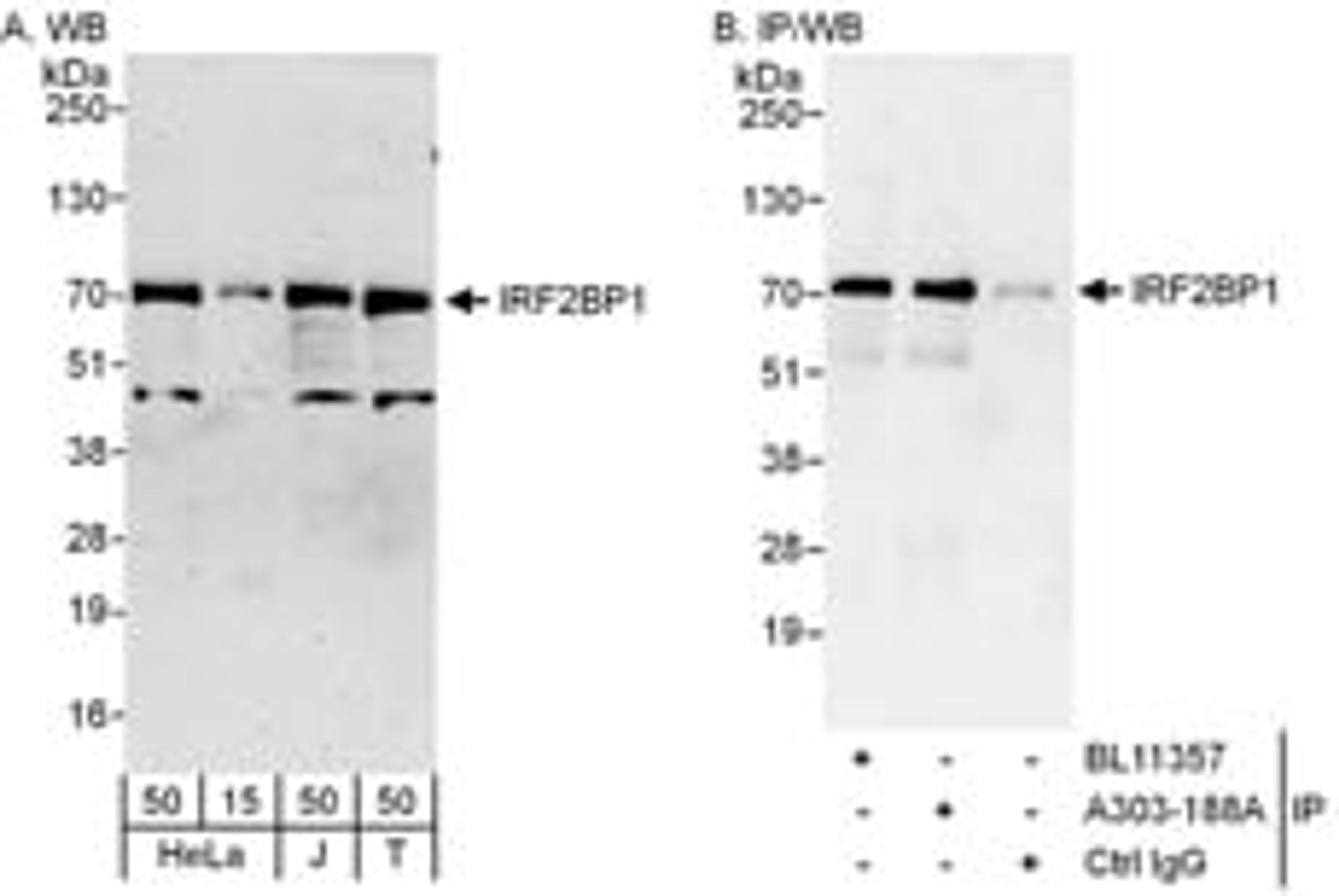 Detection of human IRF2BP1 by western blot and immunoprecipitation.