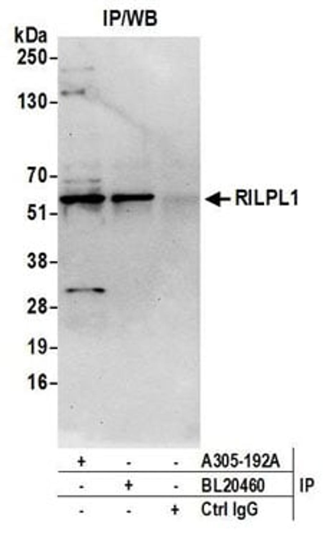 Detection of human RILPL1 by western blot of immunoprecipitates.