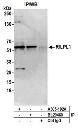 Detection of human RILPL1 by western blot of immunoprecipitates.