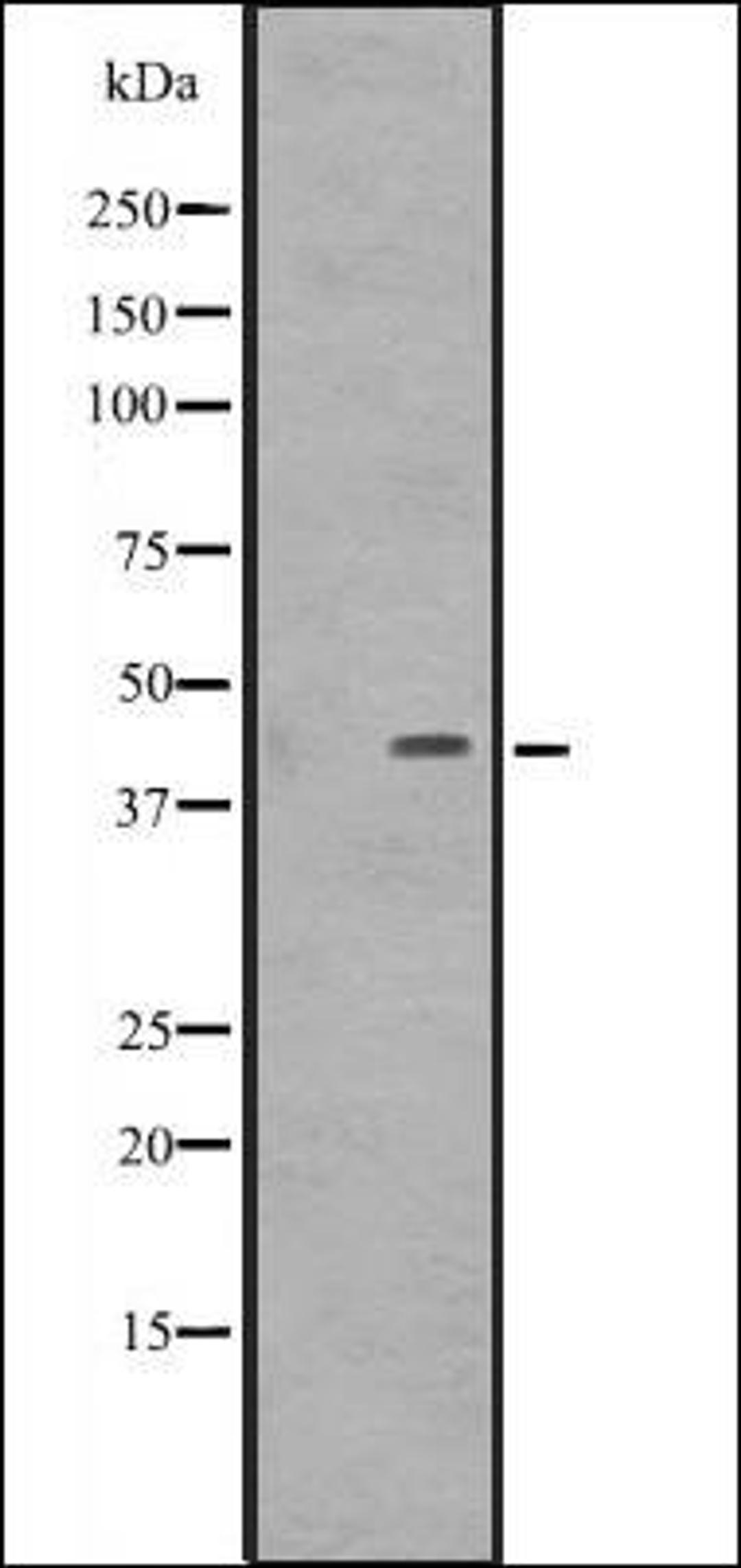 Western blot analysis of Jurkat cell lysate. using DMRTB1 antibody