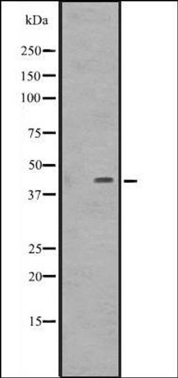 Western blot analysis of Jurkat cell lysate. using DMRTB1 antibody