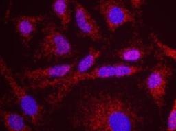 Proximity Ligation Assay: ESCO2 Antibody [NB100-87021] - Secondary-conjugate Duolink II PLA in Hela cells. goat anti-human ATM (NB100-271) and rabbit anti-human ESCO2 (NB100-87021). Image merged from DAPI (2ms) and Texas Red (200ms) exposurers, 40X magnification.