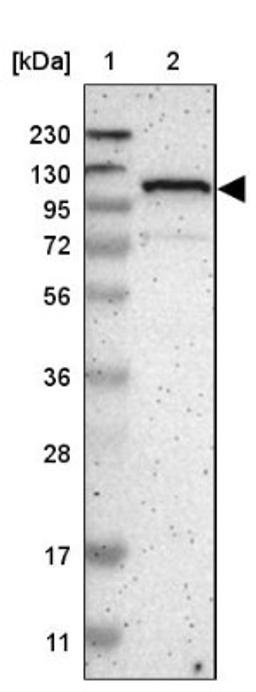 Western Blot: ZBTB11 Antibody [NBP1-80581] - Lane 1: Marker [kDa] 230, 130, 95, 72, 56, 36, 28, 17, 11<br/>Lane 2: Human cell line RT-4