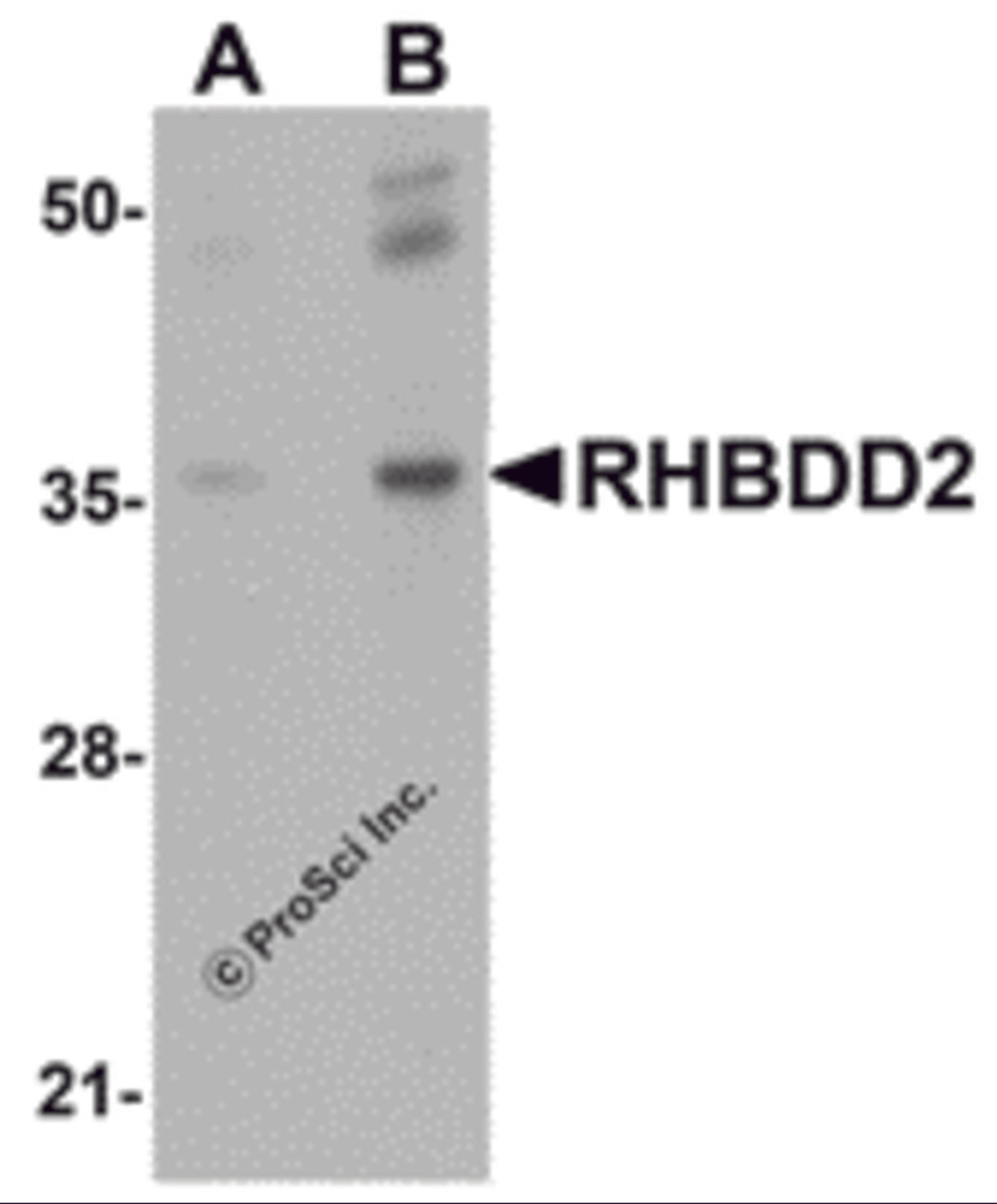Western blot analysis of RHBDD2 in rat lung tissue lysate with RHBDD2 antibody at (A) 1 and (B) 2 μg/mL.