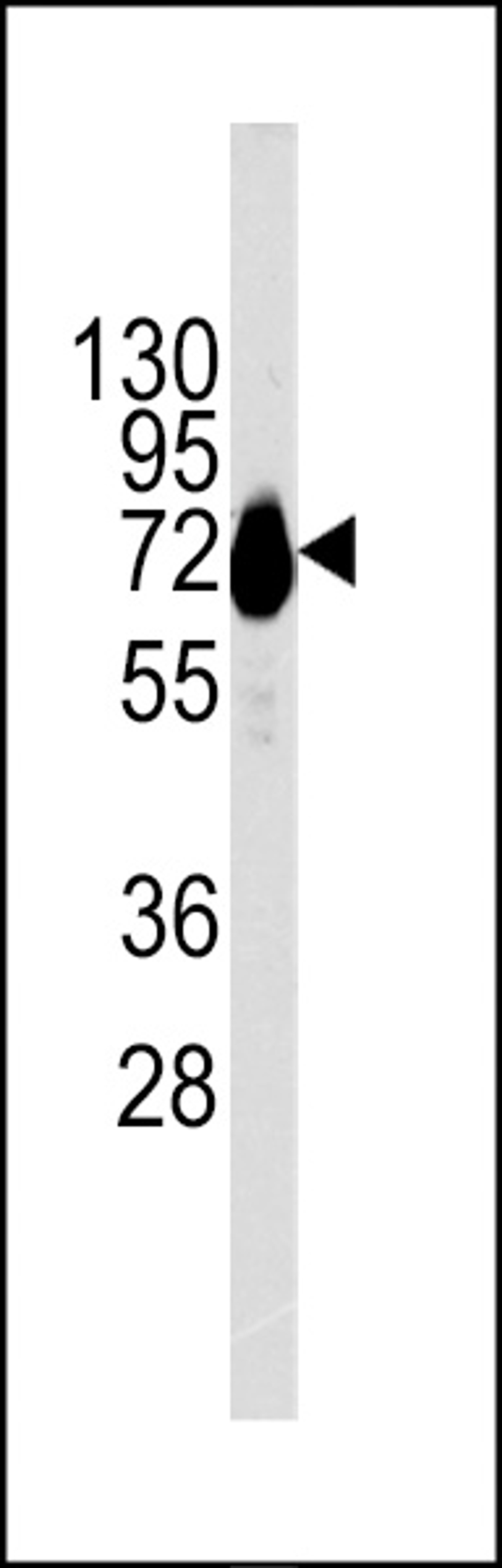 Western blot analysis of CDH10 Antibody in NCI-H460 cell line lysates (35ug/lane)