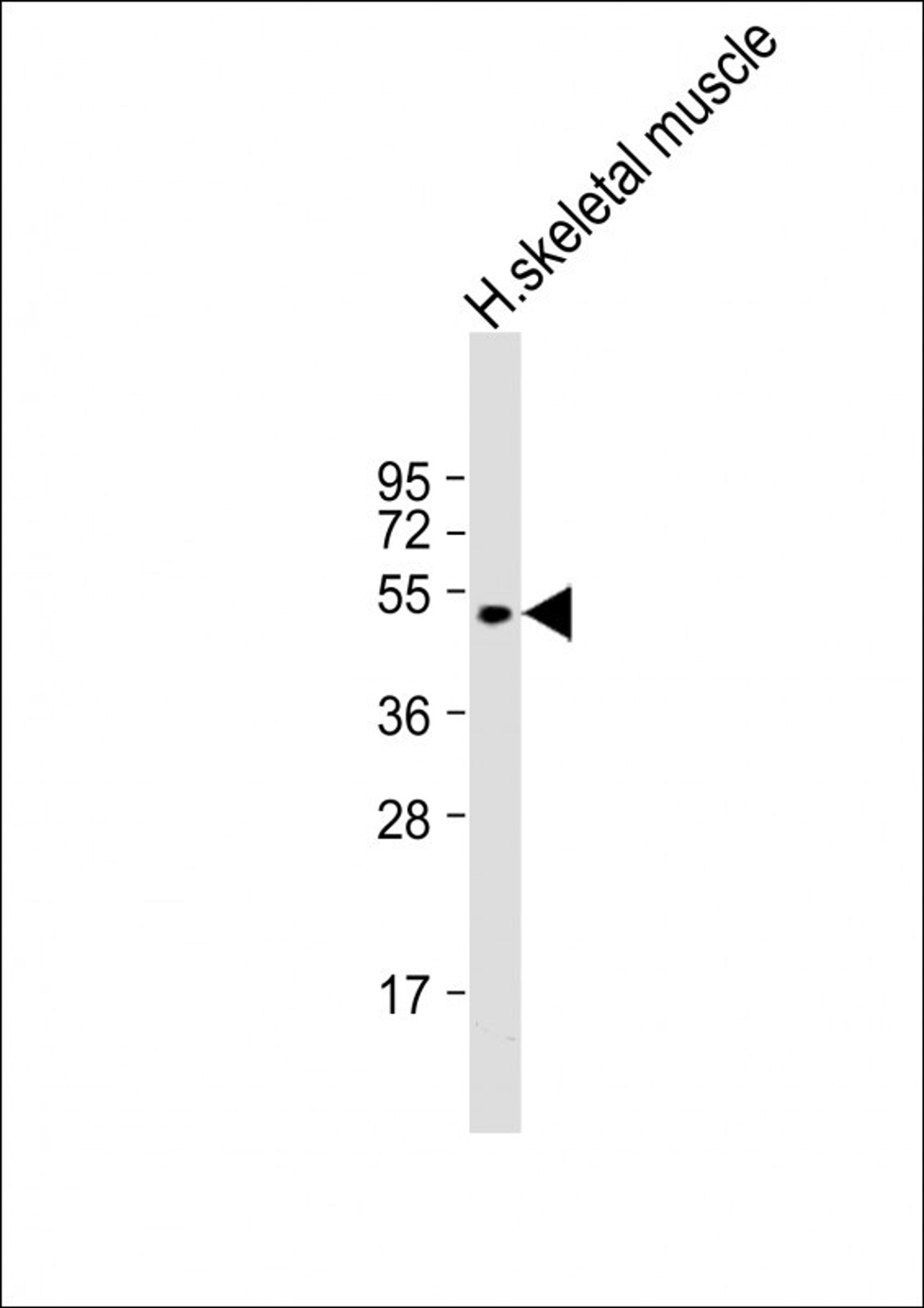 Western Blot at 1:2000 dilution + human skeletal muscle lysate Lysates/proteins at 20 ug per lane.