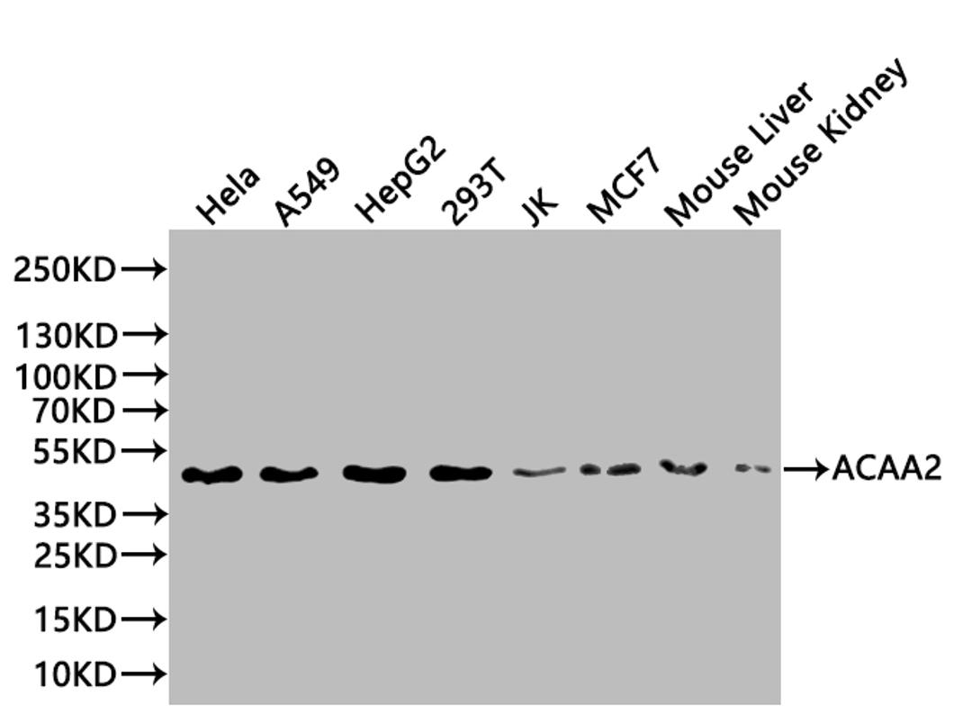 Western Blot. Positive WB detected in: MCF-7 whole cell lysate, A549 whole cell lysate, Mouse thymus. All lanes: ACAA2 antibody at 1:2000. Secondary. Goat polyclonal to rabbit IgG at 1/50000 dilution. Predicted band size: 42 kDa. Observed band size: 42 kDa. 