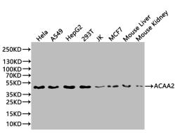 Western Blot. Positive WB detected in: MCF-7 whole cell lysate, A549 whole cell lysate, Mouse thymus. All lanes: ACAA2 antibody at 1:2000. Secondary. Goat polyclonal to rabbit IgG at 1/50000 dilution. Predicted band size: 42 kDa. Observed band size: 42 kDa. 