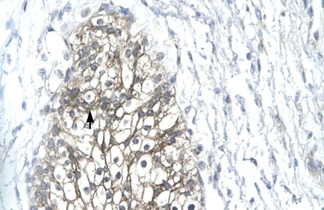 Antibody used in IHC on Human urinary bladder.