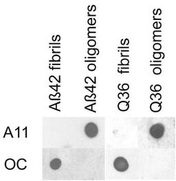 Dot Blot: Amyloid Oligomers Antibody [NBP1-97930] - Dot blot analysis of Abeta 42 and polyQ36 prefibrillar oligomers and fibrils. Abeta 42 and polyQ fibrils only stain with OC serum , while Abeta 42 and polyQ prefibrillar oligomers only react with A11 . Picture courtesy of Picture courtesy of Rakez Kayed from Glabe Lab of University of California.