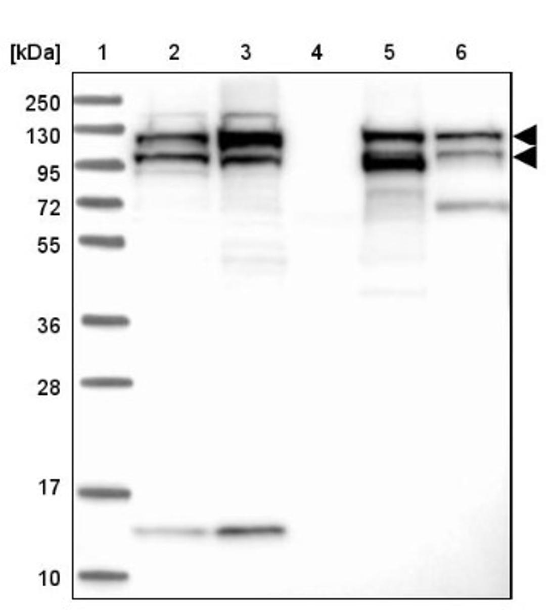 Western Blot: SEC24C Antibody [NBP1-81550] - Lane 1: Marker [kDa] 250, 130, 95, 72, 55, 36, 28, 17, 10<br/>Lane 2: Human cell line RT-4<br/>Lane 3: Human cell line U-251MG sp<br/>Lane 4: Human plasma (IgG/HSA depleted)<br/>Lane 5: Human liver tissue<br/>Lane 6: Human tonsil tissue