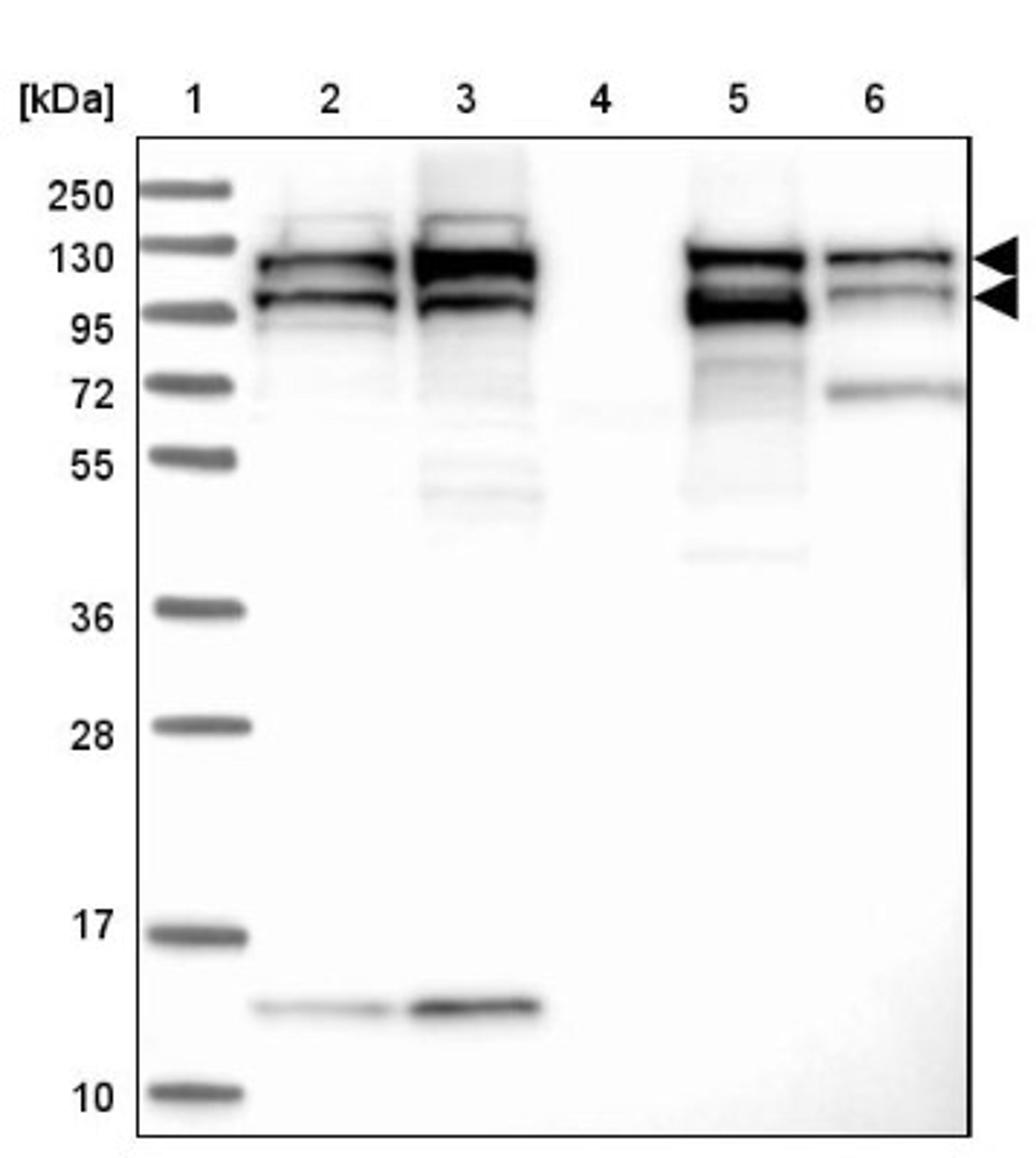 Western Blot: SEC24C Antibody [NBP1-81550] - Lane 1: Marker [kDa] 250, 130, 95, 72, 55, 36, 28, 17, 10<br/>Lane 2: Human cell line RT-4<br/>Lane 3: Human cell line U-251MG sp<br/>Lane 4: Human plasma (IgG/HSA depleted)<br/>Lane 5: Human liver tissue<br/>Lane 6: Human tonsil tissue