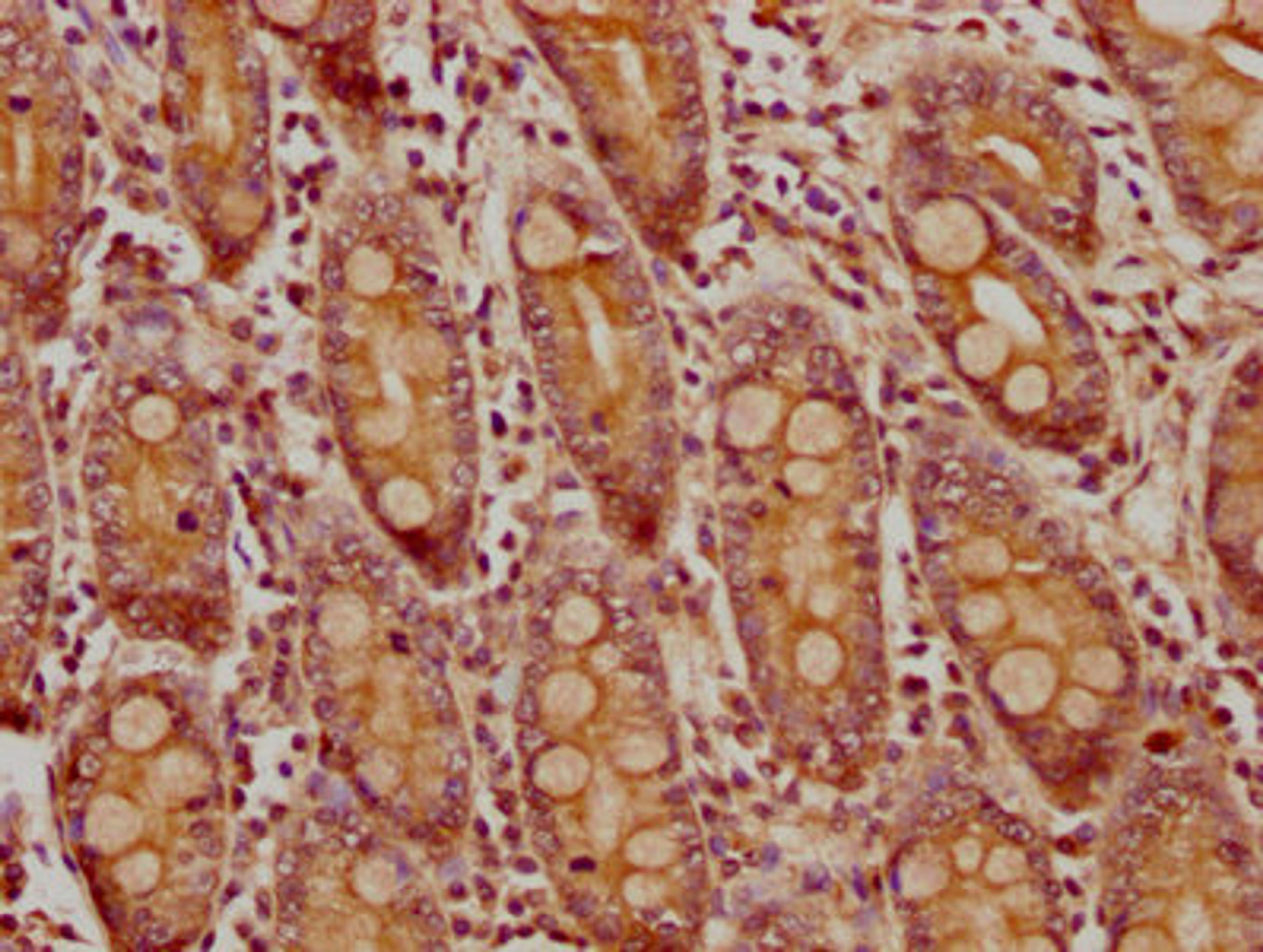 IHC image of CSB-PA764727LA01HU diluted at 1:300 and staining in paraffin-embedded human small intestine tissue performed on a Leica BondTM system. After dewaxing and hydration, antigen retrieval was mediated by high pressure in a citrate buffer (pH 6.0). Section was blocked with 10% normal goat serum 30min at RT. Then primary antibody (1% BSA) was incubated at 4&deg;C overnight. The primary is detected by a biotinylated secondary antibody and visualized using an HRP conjugated SP system.