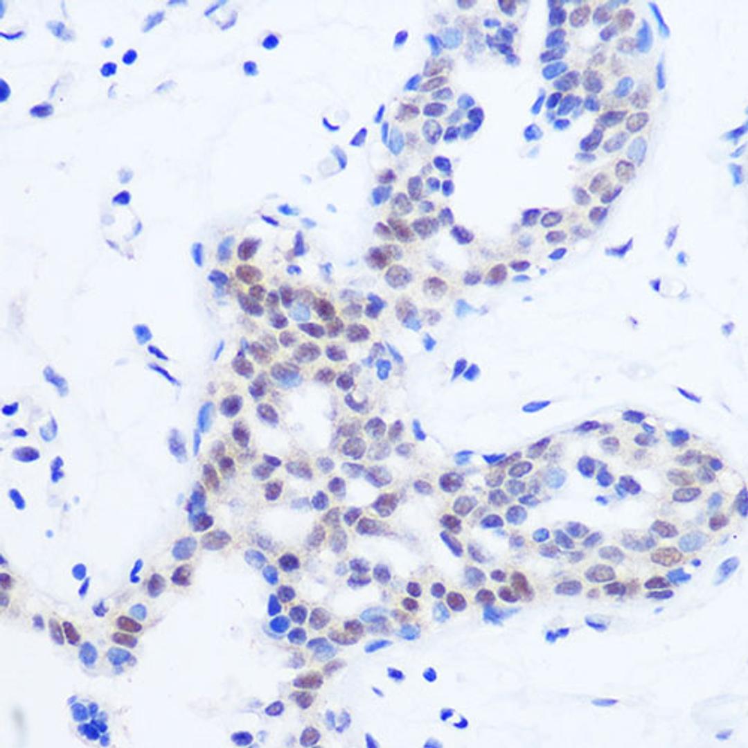 Immunohistochemistry  - SRSF11 Rabbit pAb (A18404)