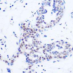 Immunohistochemistry - SRSF11 Rabbit pAb (A18404)