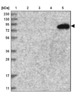 Western Blot: TATDN2 Antibody [NBP1-93652] - Lane 1: Marker [kDa] 230, 130, 95, 72, 56, 36, 28, 17, 11<br/>Lane 2: Human cell line RT-4<br/>Lane 3: Human cell line U-251MG sp<br/>Lane 4: Human plasma (IgG/HSA depleted)<br/>Lane 5: Human liver tissue