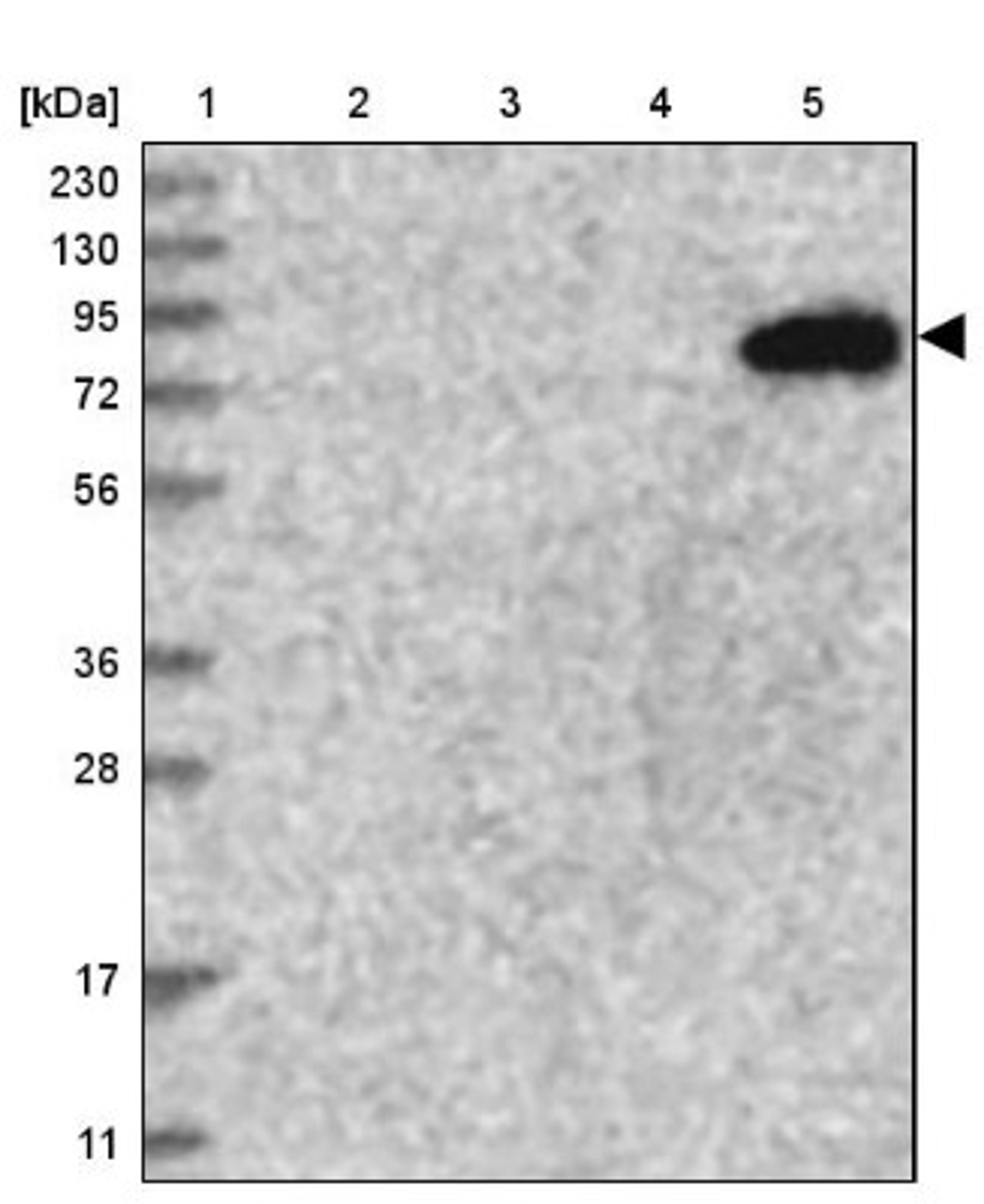 Western Blot: TATDN2 Antibody [NBP1-93652] - Lane 1: Marker [kDa] 230, 130, 95, 72, 56, 36, 28, 17, 11<br/>Lane 2: Human cell line RT-4<br/>Lane 3: Human cell line U-251MG sp<br/>Lane 4: Human plasma (IgG/HSA depleted)<br/>Lane 5: Human liver tissue