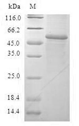 (Tris-Glycine gel) Discontinuous SDS-PAGE (reduced) with 5% enrichment gel and 15% separation gel.