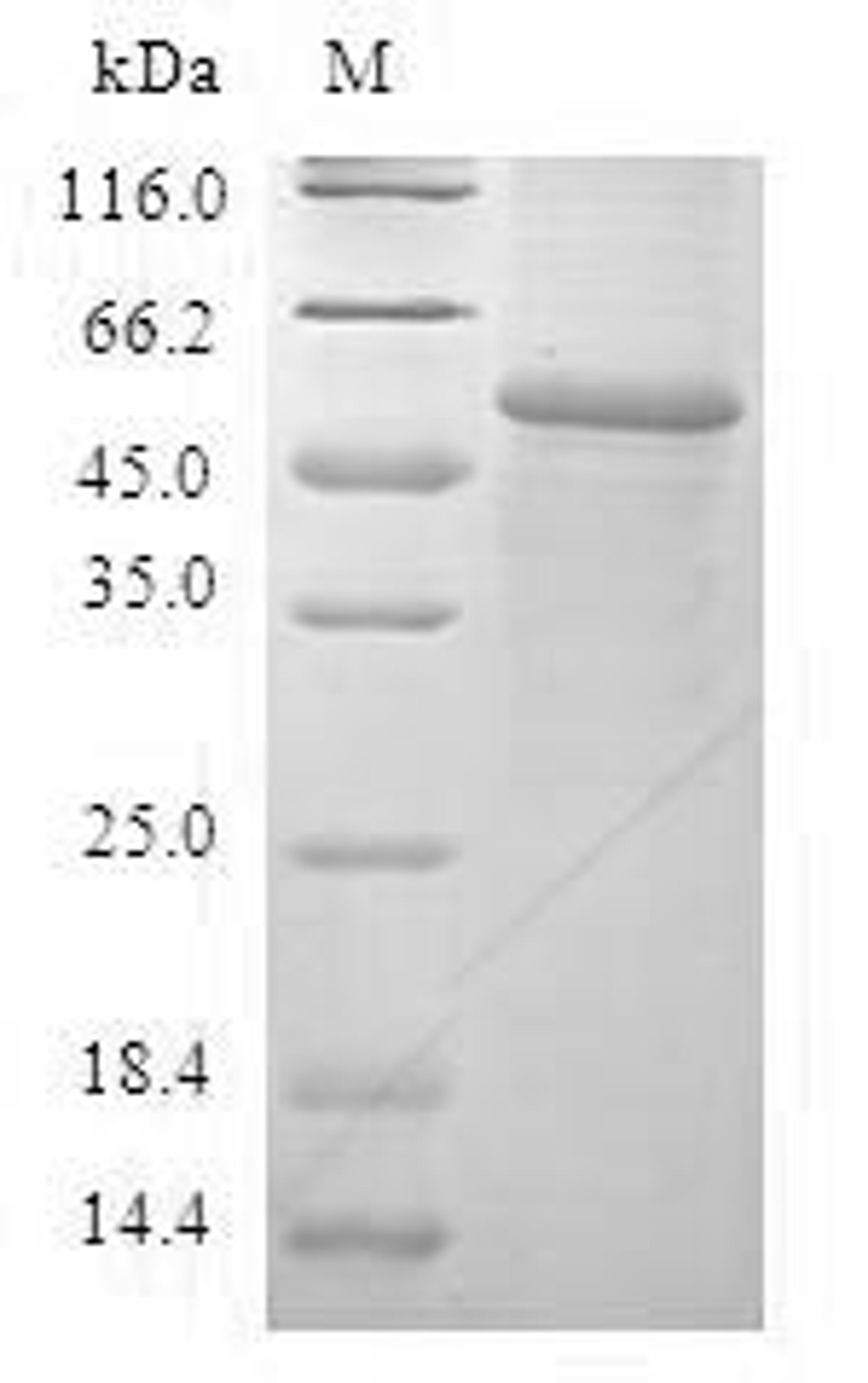 (Tris-Glycine gel) Discontinuous SDS-PAGE (reduced) with 5% enrichment gel and 15% separation gel.