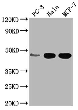Western Blot. Positive WB detected in: PC-3 whole cell lysate, Hela whole cell lysate, MCF-7 whole cell lysate. All lanes: CCDC74B antibody at 1:2000. Secondary. Goat polyclonal to rabbit IgG at 1/50000 dilution. Predicted band size: 42, 36 kDa. Observed band size: 42 kDa. 