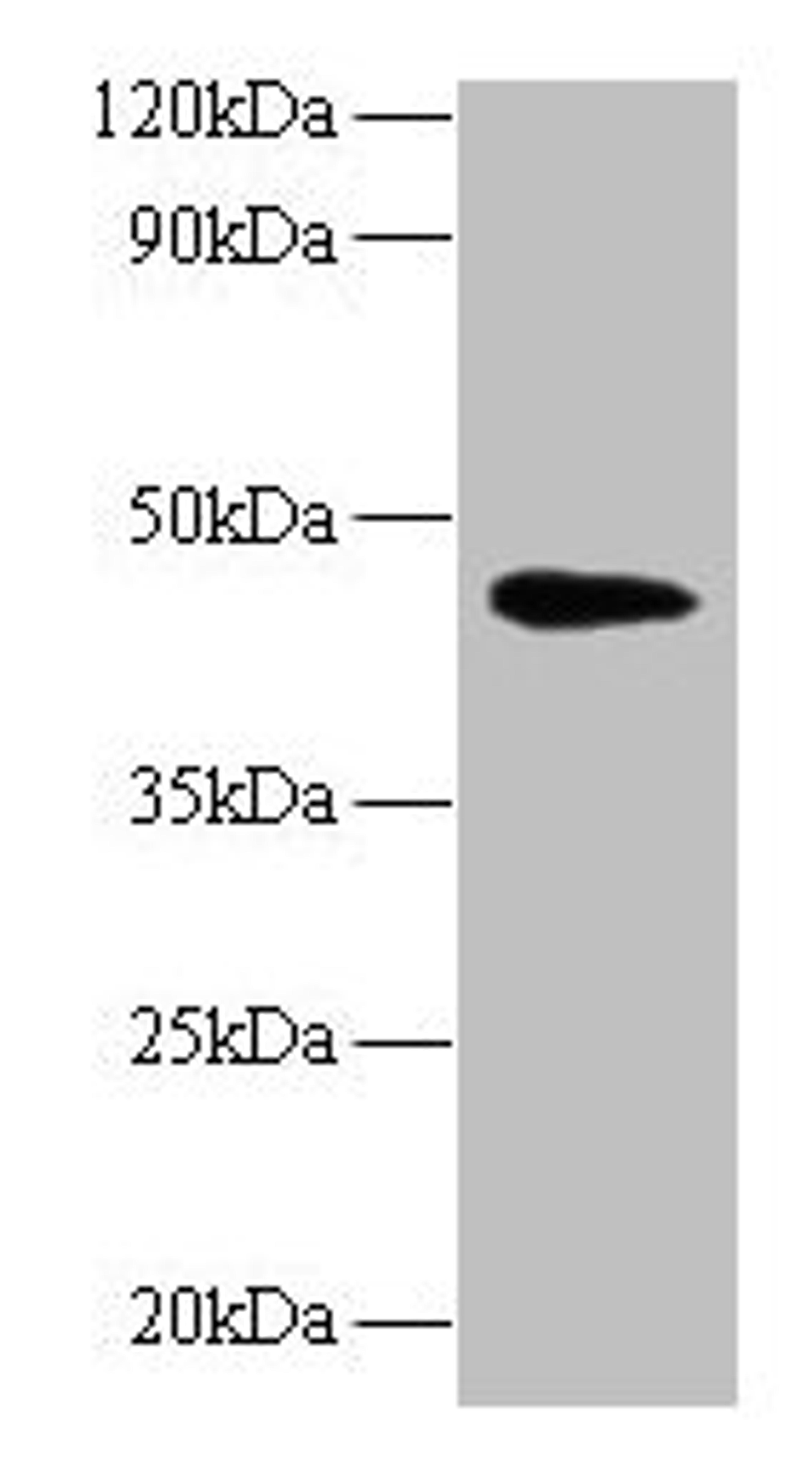 Western blot. All lanes: NAPSA antibody at 2µg/ml + Mouse kidney tissue. Secondary. Goat polyclonal to rabbit IgG at 1/10000 dilution. Predicted band size: 46 kDa. Observed band size: 46 kDa