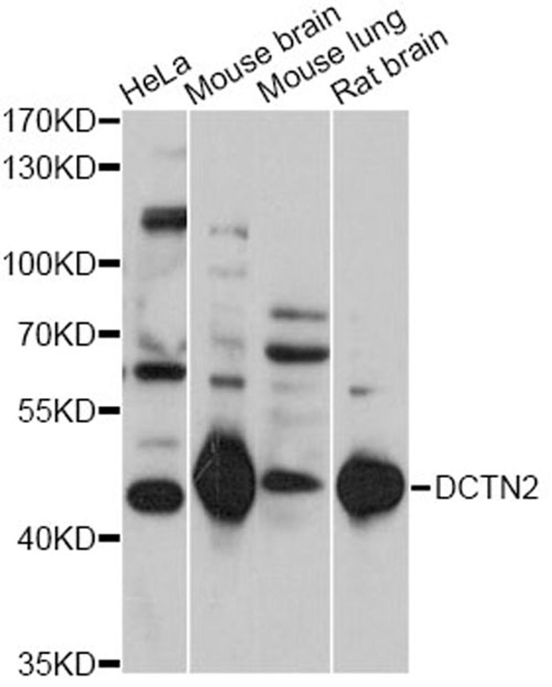 Western blot - DCTN2 antibody (A14841)