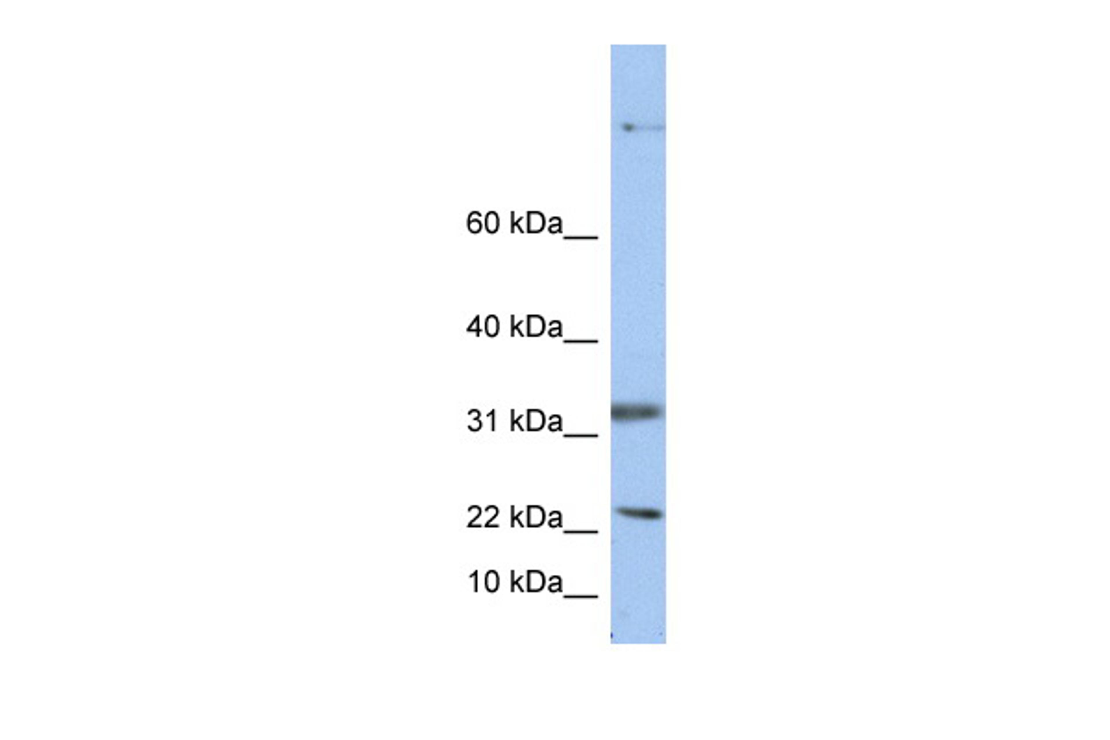 Antibody used in WB on Human HepG2 at 0.2-1 ug/ml.