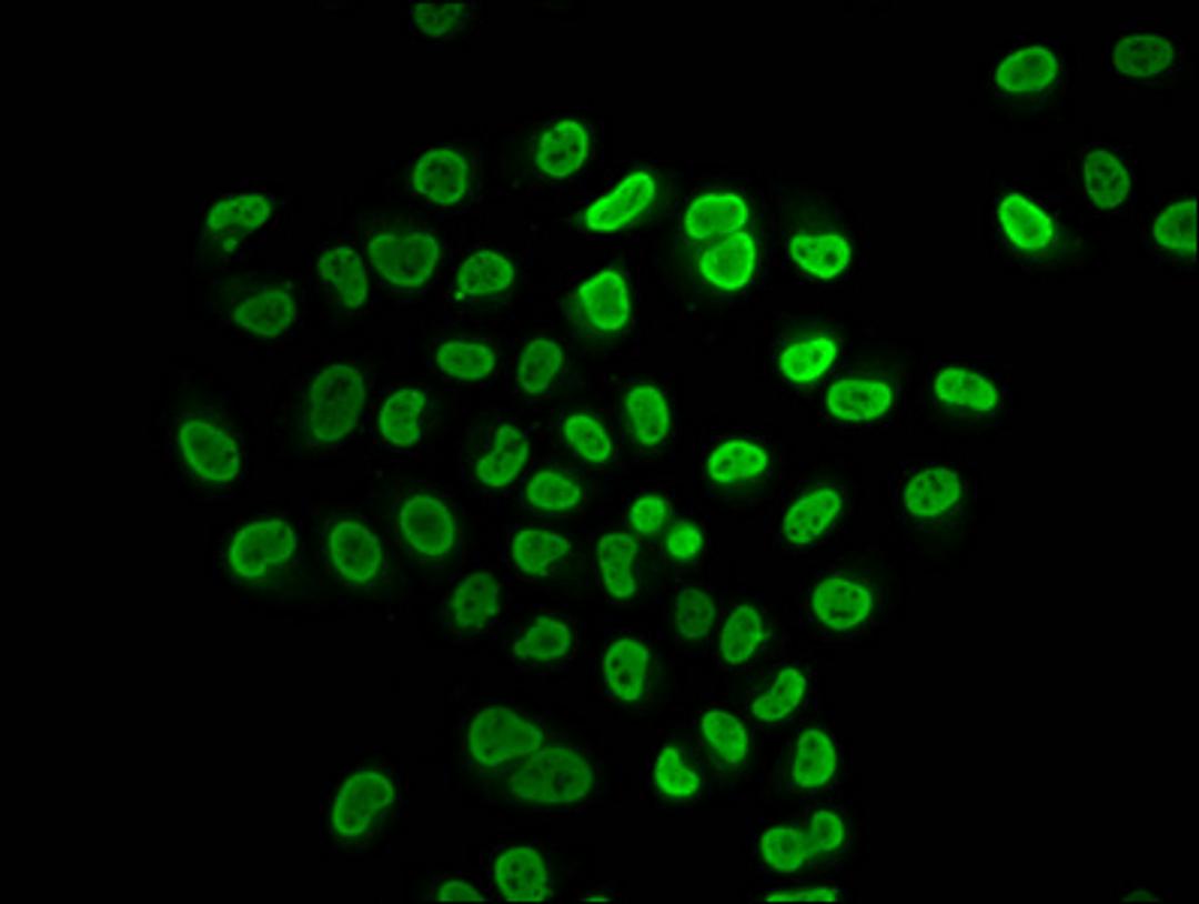 Immunofluorescence staining of Hela cells (treated with 30mM sodium butyrate for 4h) with CSB-PA010429OA31butHU at 1:25, counter-stained with DAPI. The cells were fixed in 4% formaldehyde, permeabilized using 0.2% Triton X-100 and blocked in 10% normal Goat Serum. The cells were then incubated with the antibody overnight at 4&deg;C. The secondary antibody was Alexa Fluor 488-congugated AffiniPure Goat Anti-Rabbit IgG(H+L).