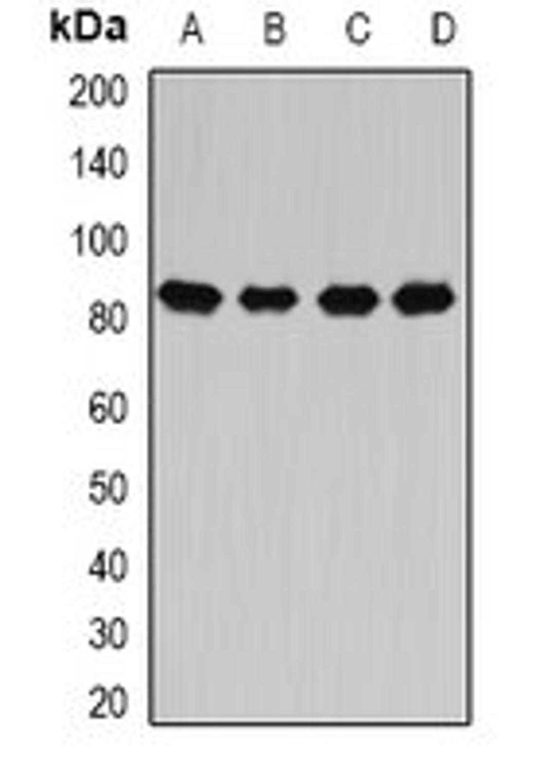 Western blot analysis of Hela (Lane1), MCF7 (Lane2), mouse liver (Lane3), rat spinal cord (Lane4) whole cell lysates using CARS antibody