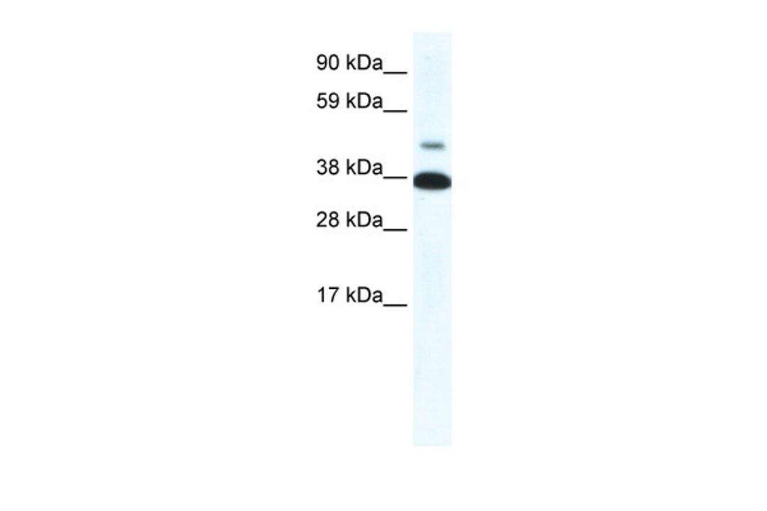 Antibody used in WB on Human Muscle at 0.2-1 ug/ml.