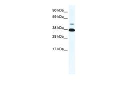 Antibody used in WB on Human Muscle at 0.2-1 ug/ml.